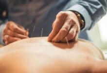 Acupunctura pentru neuropatia periferică 9 acupunctura inflamatie